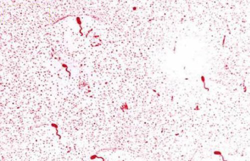 黑臭水體中微生物的來源有哪些？